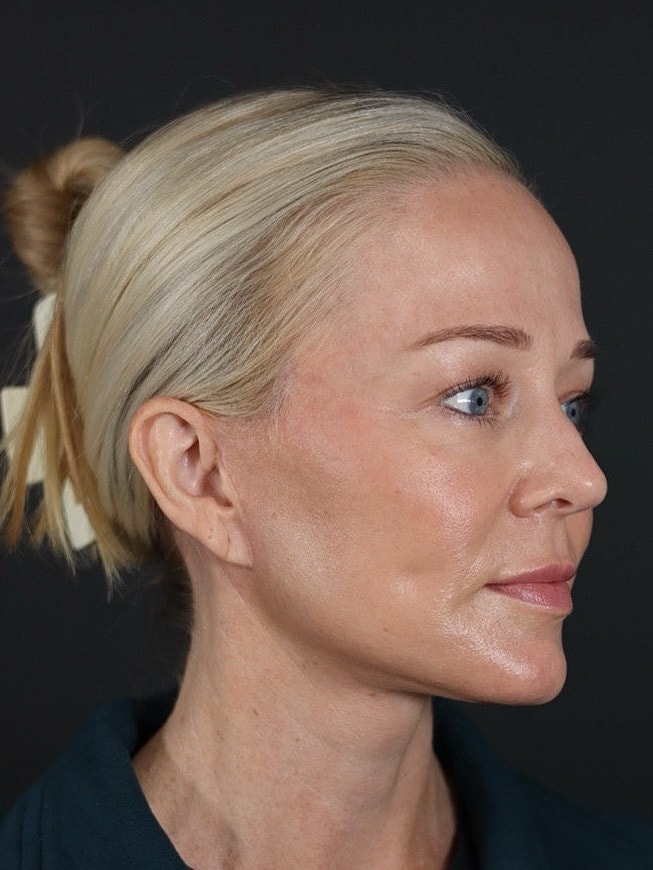 Profile of a woman with blonde hair.