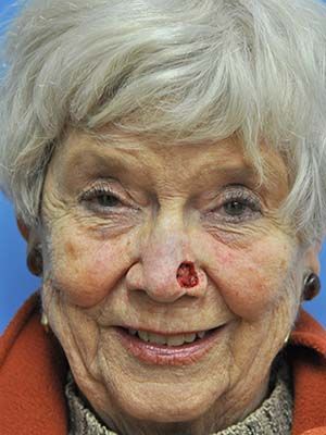 Reconstruction Before & After