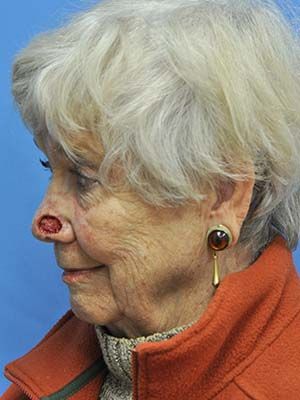 Reconstruction Before & After