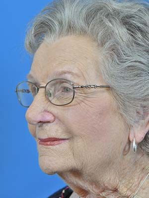 Reconstruction Before & After