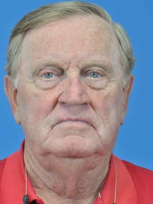 Reconstruction Before & After