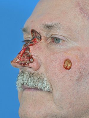 Reconstruction Before & After