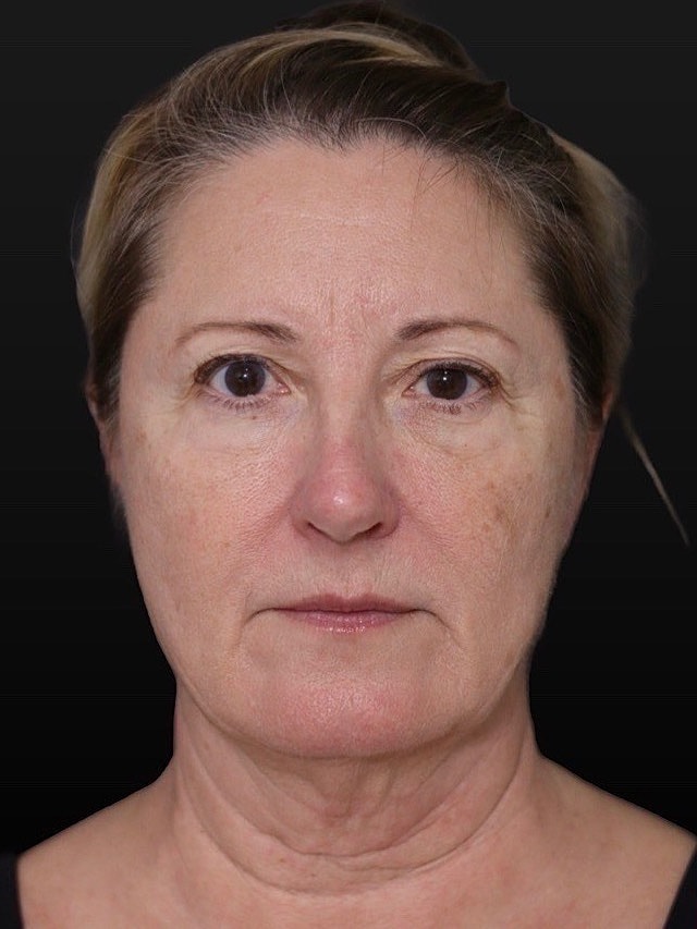 Woman with neutral expression against black background.