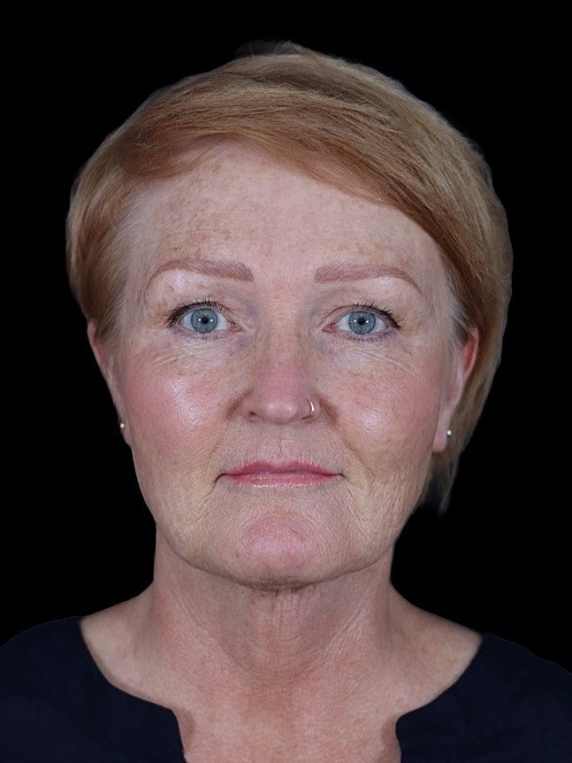 Older woman with short, light hair and blue eyes.
