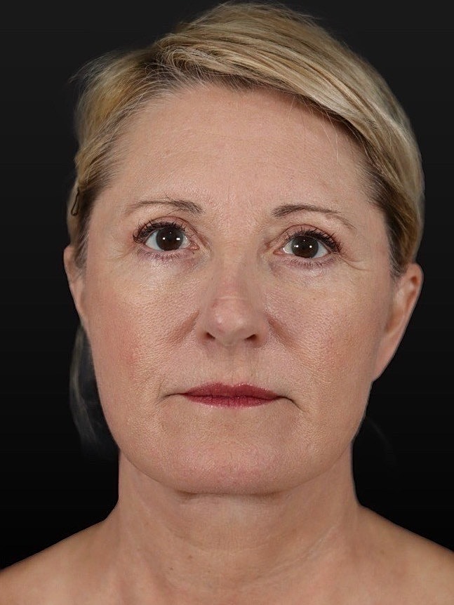 Portrait of a woman with light blonde hair.