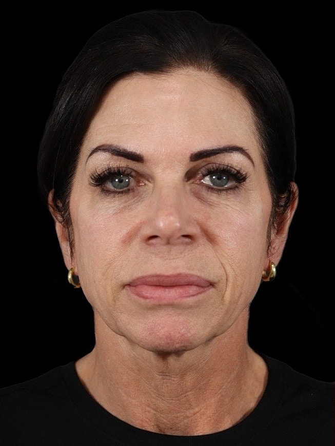 Middle-aged woman with dark hair and makeup.