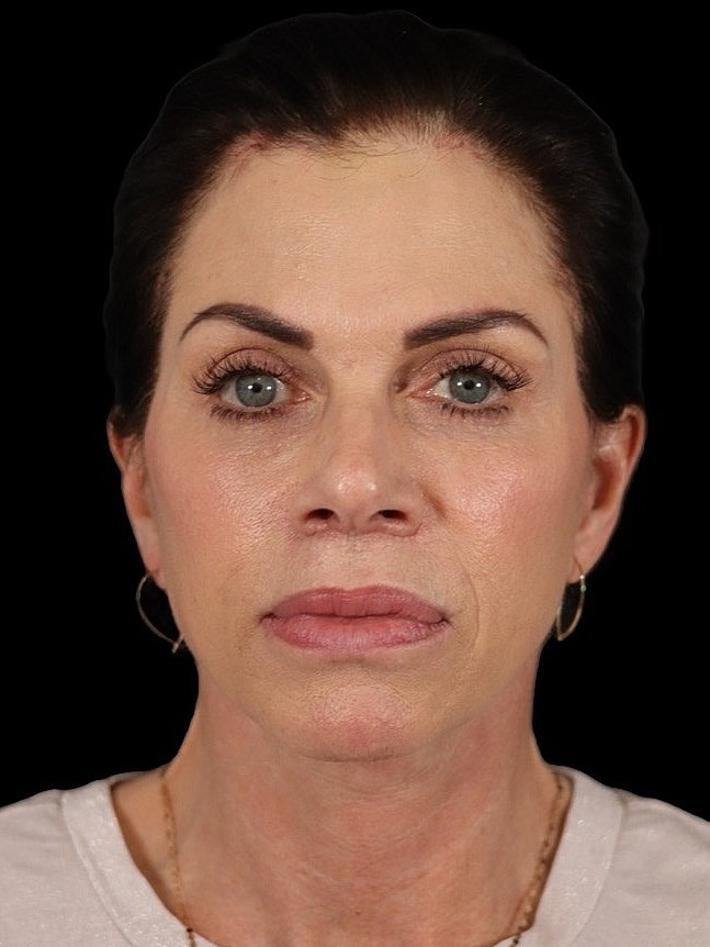 Woman with light makeup and soft expression.