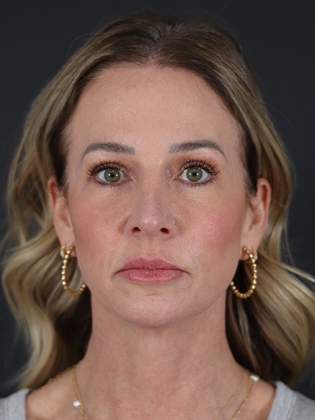 Woman with long hair and hoop earrings.